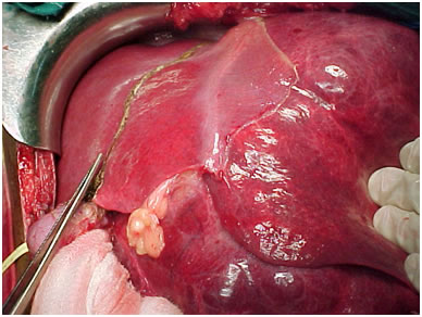 Haemangiomas